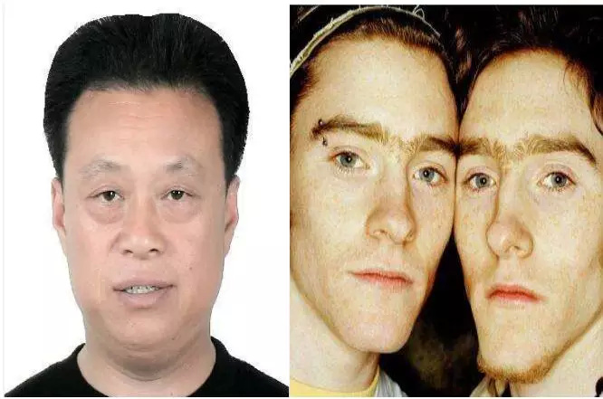 男人颧骨高面相固)