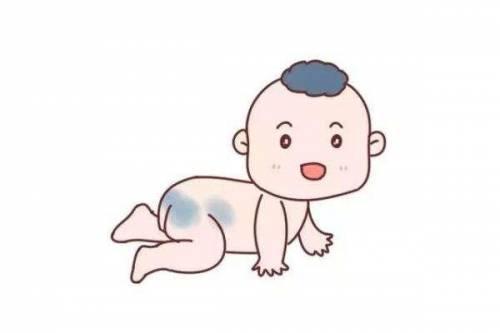青胎记长在这里需警惕!