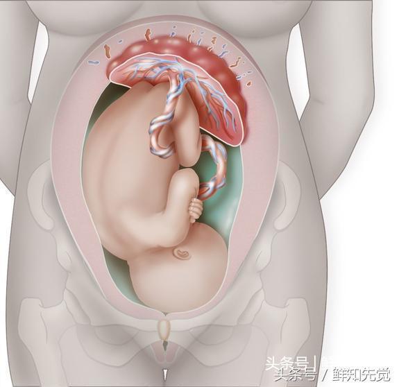 入盆图解:预示着胎儿已顺利入盆5种表现!
