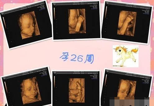 怀孕26周了,胎儿在肚子会是什么姿势呢?看完你