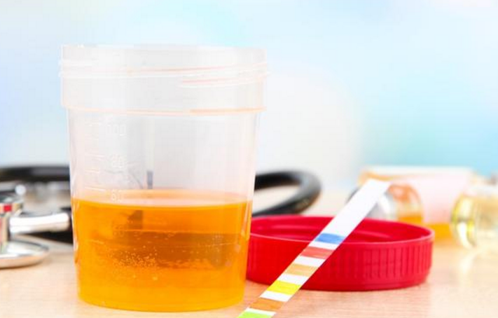 体检出尿酸偏高怎么降?用这4种食物熬汤喝,尿