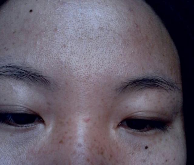 妇科中医:女人气血不足,面部暗沉长黄褐斑,3物