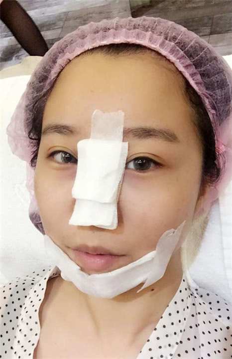 垫过鼻子的人，到老了会怎样？医生告诉你答案