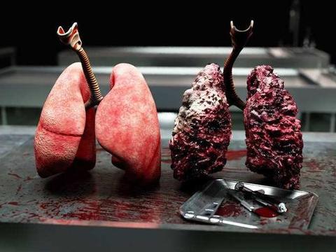 肺癌是被香烟"熏"出来的,医生劝告:三种人最好抓紧戒烟!