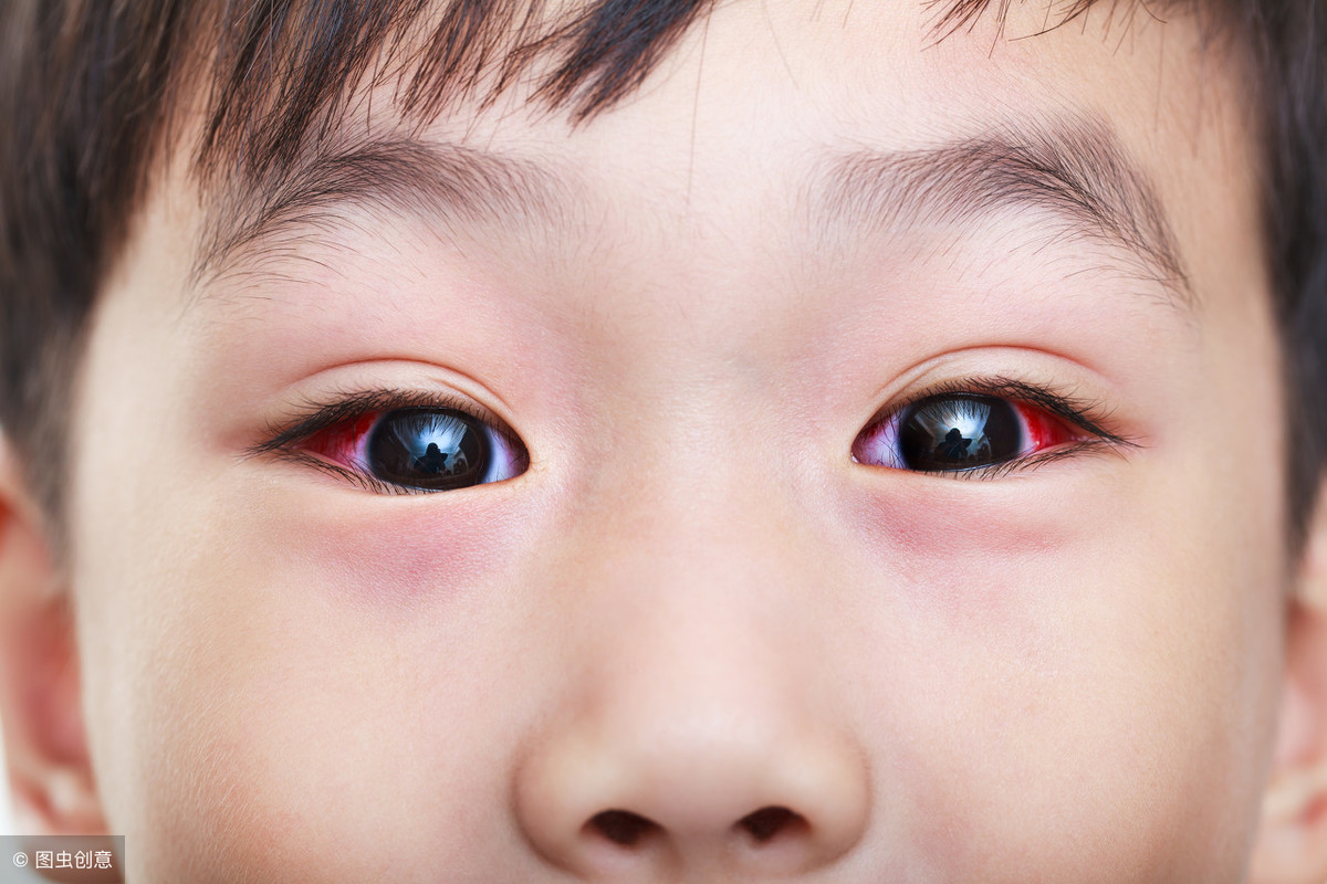 儿童视神经萎缩的病因有哪些？_厦门大学附属厦门眼科中心