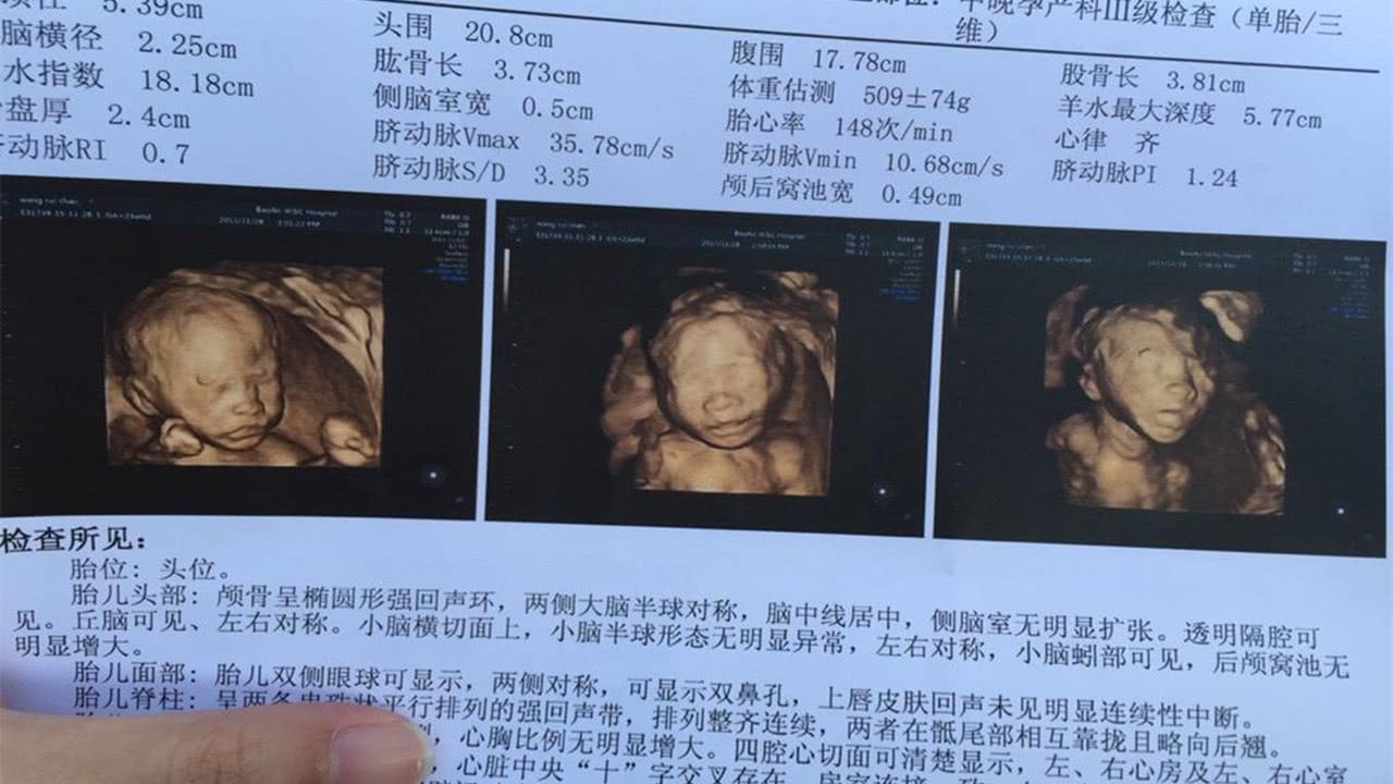 孕13周刚刚进入孕中期的胎宝宝现在大概发育成什么样了