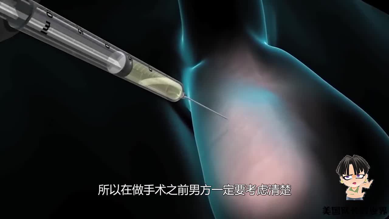 男性结扎手术对身体有害吗?3d动画演示全过程,看完背后一凉!