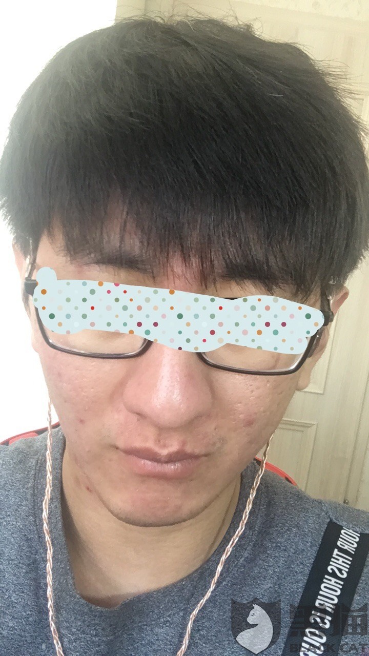 黑猫投诉:痘博士虚假宣传,诱导贷款,故意误诊,没