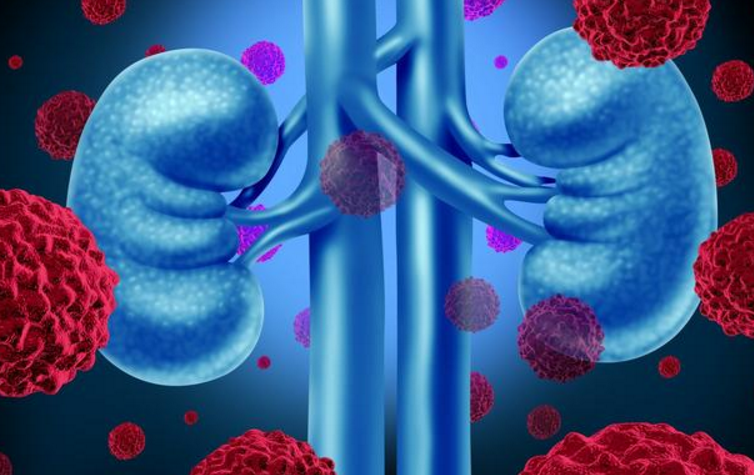 体检出尿酸偏高怎么降?用这4种食物熬汤喝,尿