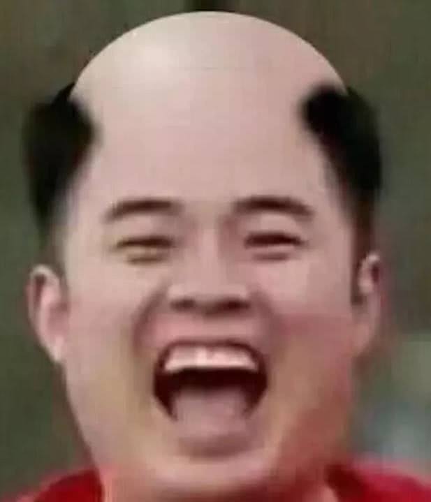 娱乐圈又一位男明星要"秃顶",发际线高的吓人,看起来"