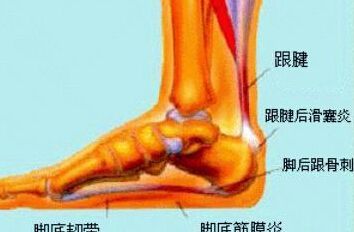 足跟痛如何艾灸治疗?