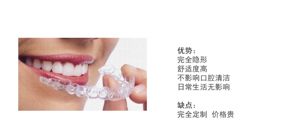 苏州王先军主任：牙齿矫正有哪些准备和事项