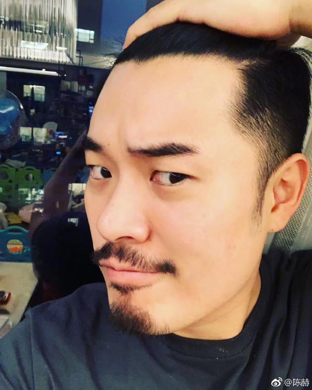 陈赫晒照露出额头 自称发际线上移:秃顶指日可待