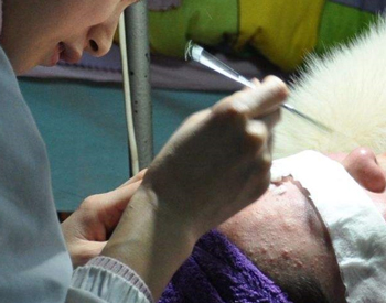 宋慧护肤:美容院针清靠谱吗?这种闭口粉刺可以用针清去除吗?