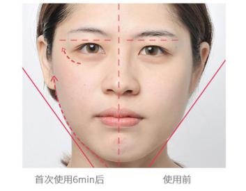 明星辣妈佟丽娅戚薇的冻龄秘诀--雅萌射频美容仪