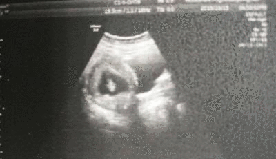 怀孕几个月可以看出男女