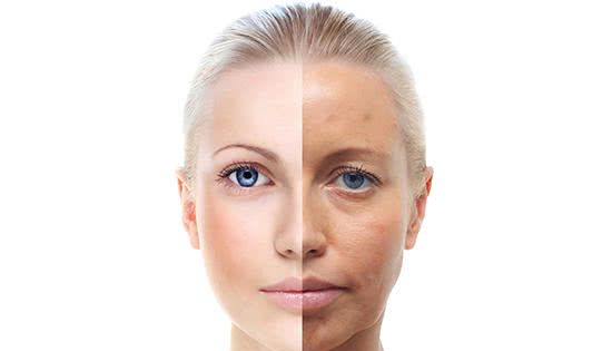 v女生卡粉,浮粉?这些知道女生你一定要解决!办法试玩小游戏图片