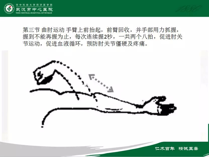 picc置管后为什么要进行功能锻炼?