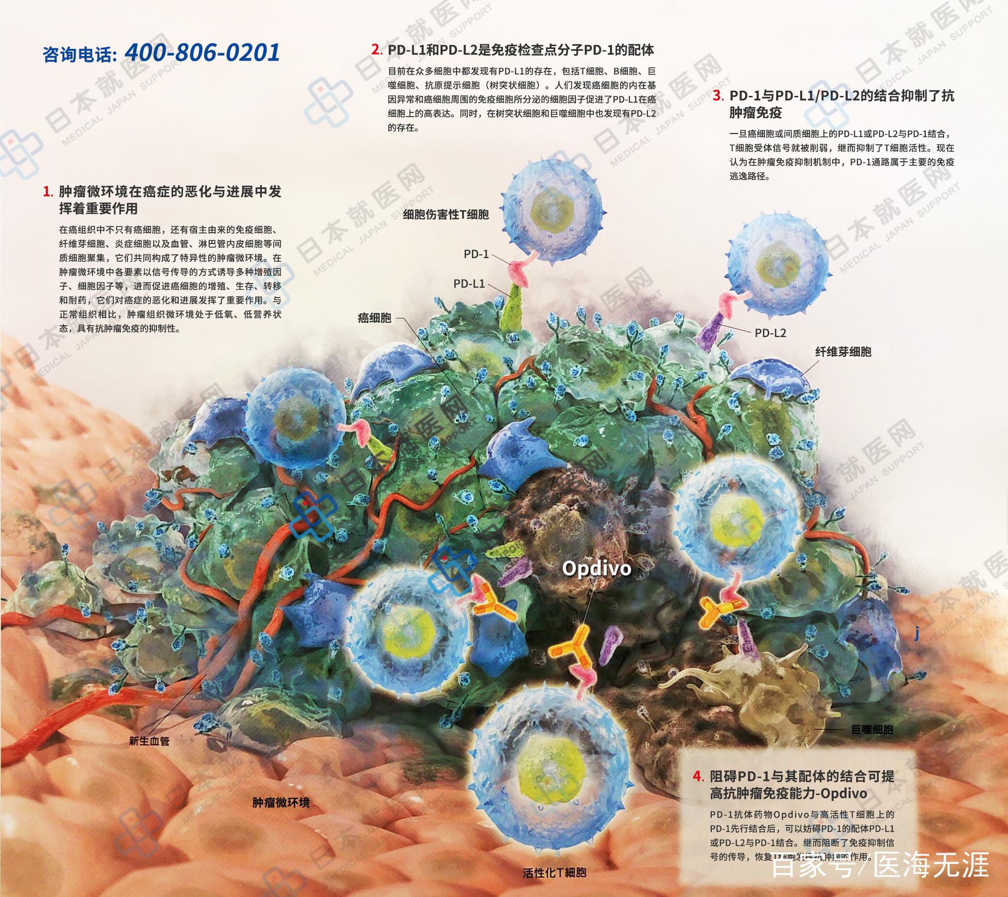 肿瘤治疗仪，医疗产品，造型设计 【南京欧爱工业设计公司】