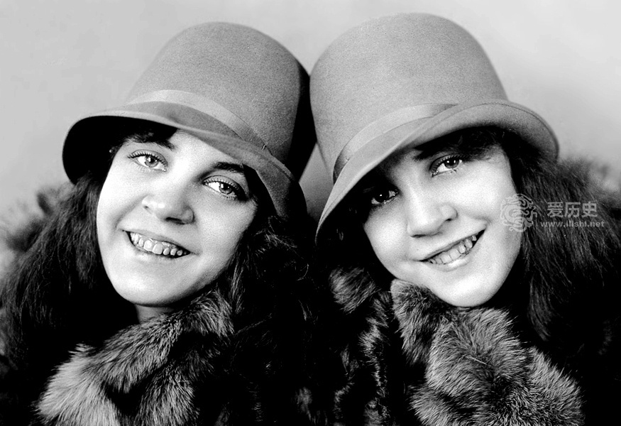 世界上最著名的连体双胞胎 被霸占20年晚年境遇好凄惨|希尔顿|姐妹