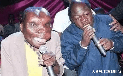 他是史上最丑的男人，却有无数少女想嫁给他，大开眼界