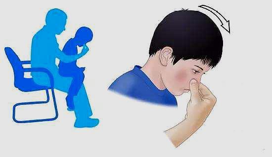 宝宝流鼻血妈妈总是让孩子们把头仰起来,