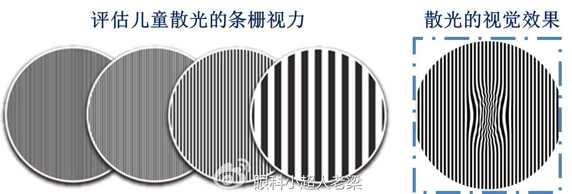 高度散光