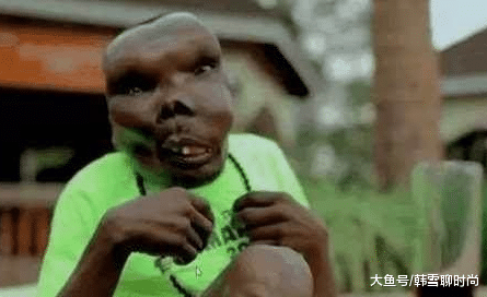 他是史上最丑的男人，却有无数少女想嫁给他，大开眼界