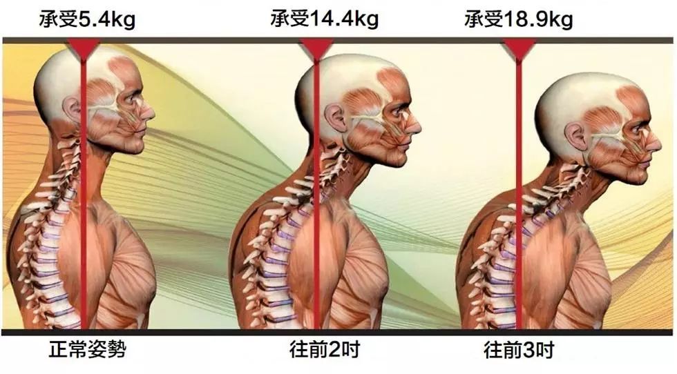 颈部僵硬怎么办?这 5 个绝招帮你搞掂!