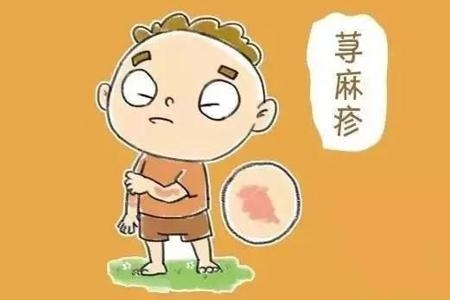 一遇冷空气就起风团，这是寒冷性荨麻疹！教你三招赶走荨麻疹！