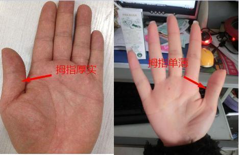 这根手指长的人，被称为“发财手”