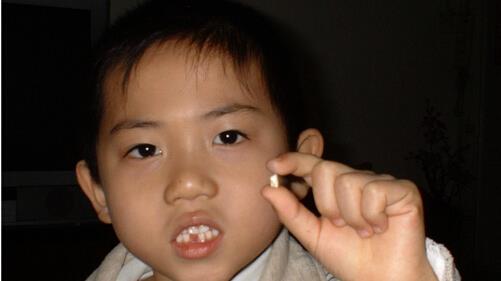 孩子几岁开始换乳牙?关于换牙年龄早晚,影响