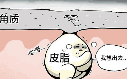 治疗闭合黑白头粉刺用什么护肤品?毛孔疏通技