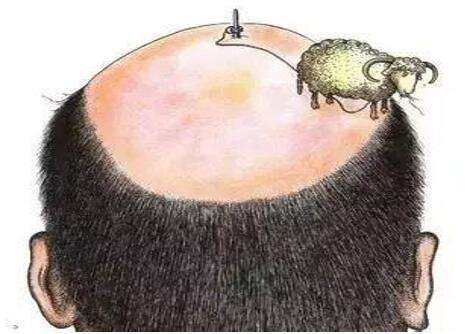 身边的朋友忙着脱单，而我却忙着脱发！