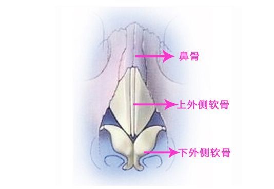 从单纯隆鼻到复合隆鼻再到鼻综合整形，原来没选对隆鼻方式真的会变丑