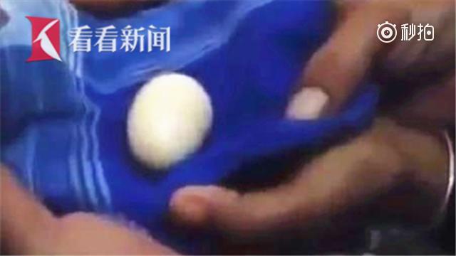 印尼14岁男孩两年产20枚蛋