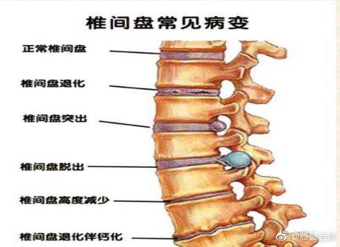 腰椎骨折没有去康复医院可以申请人身保险伤残鉴定吗