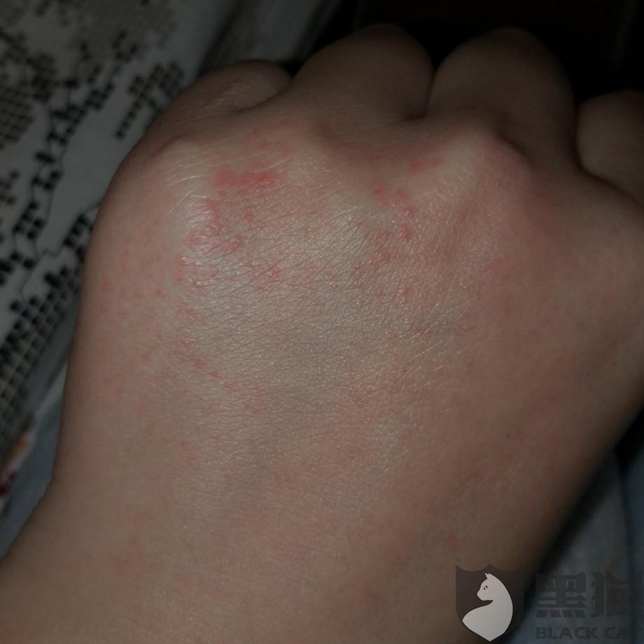 梦见被猫抓伤了手擦了药，探索梦境背后的深层含义