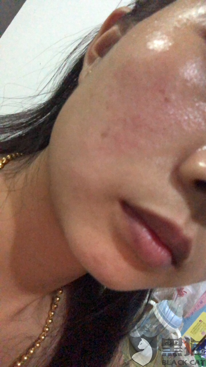 黑猫投诉微信平台购物在有米日记买了一瓶兰蔻大粉水是假货