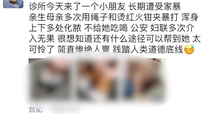 合肥警方通报10岁幼女遭生母虐待：其母用烫红的火钳夹烫，被训诫后仍殴打