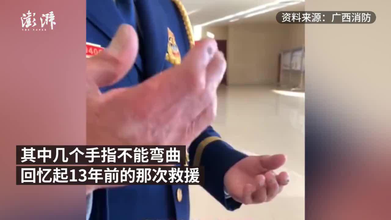 33岁消防员双手似古稀老人13年前被烧伤仍坚守一线