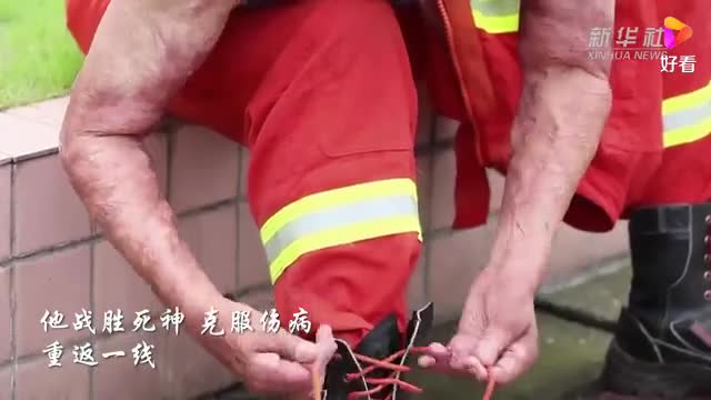 全身烧伤60%消防员重返一线 满身伤痕却成为他最美勋章