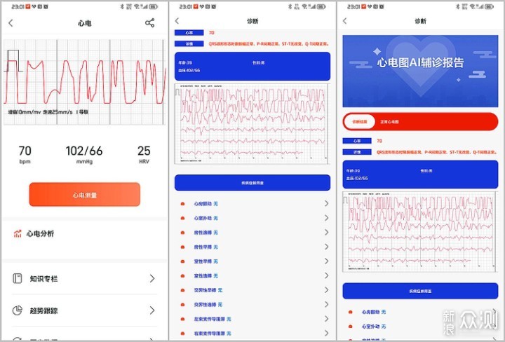 智能手錶推薦:血糖監測功能全面送長輩倍有心_新浪眾測