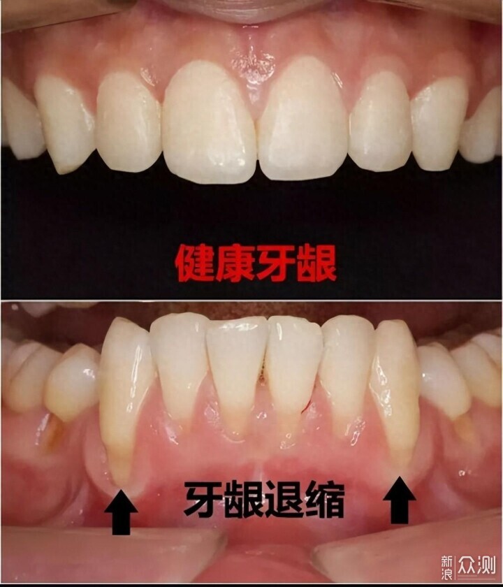 衝牙器被小米玩出花了:米家電動衝牙器F300_新浪眾測