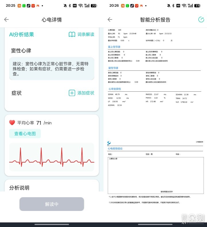 精準記錄，樂普Lepod Pro多導聯心電記錄儀_新浪眾測