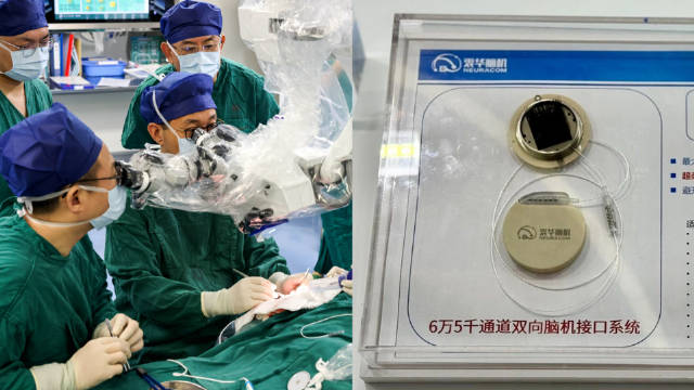 首个全国产高通道脑机接口临床测试