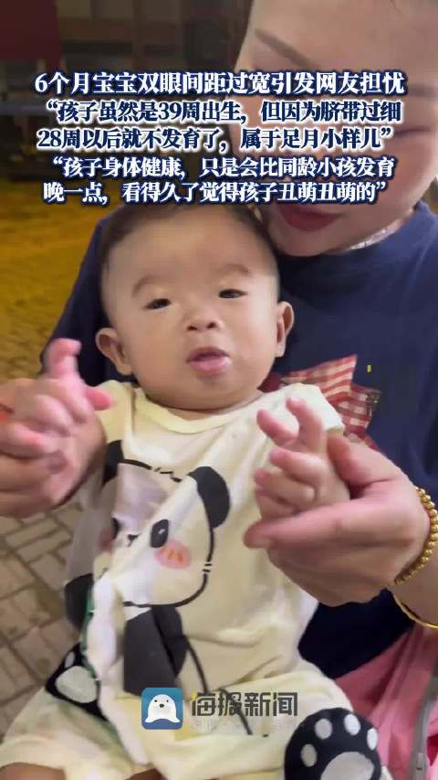妈妈回应6个月宝宝眼距过宽引担忧：孩子身体健康，只是会比同龄小孩发育晚一点