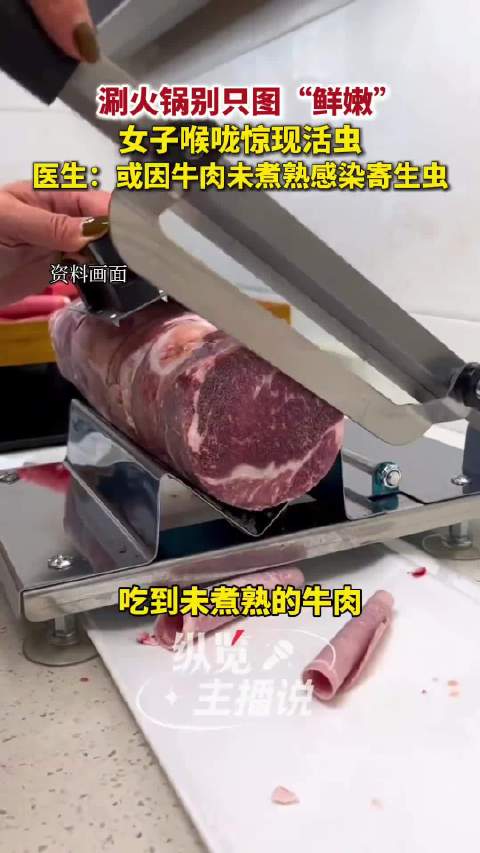 女子吃完火锅后喉咙惊现活虫