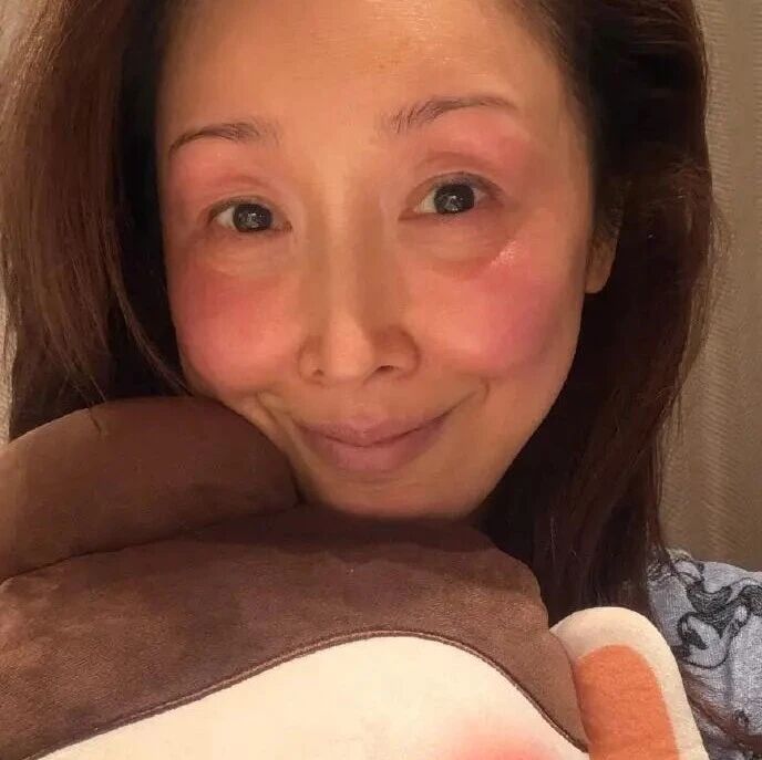 知名女歌手自曝：录春晚被冻伤！素颜照满脸通红，网友直呼心疼：零下20℃，太冷了