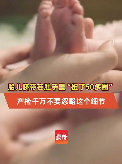 胎儿在肚子里“扭了50圈”，妈妈毫无察觉，产检千万不要忽略这个细节